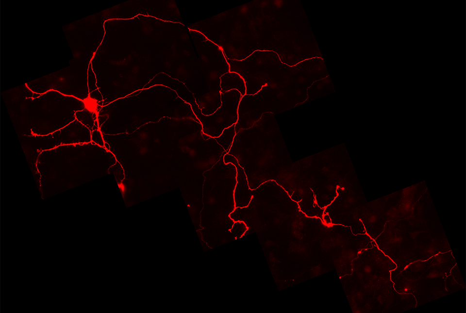 immunofluorescent image of neurons stained for dopamine