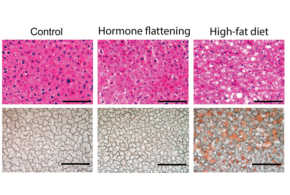 histology of liver tissue