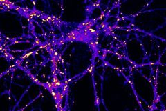 Neurons stained for lipid droplets